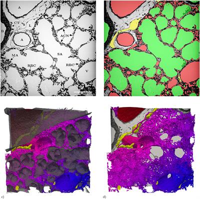 Assessment of the Alveolar Capillary Network in the Postnatal Mouse Lung in 3D Using Serial Block-Face Scanning Electron Microscopy